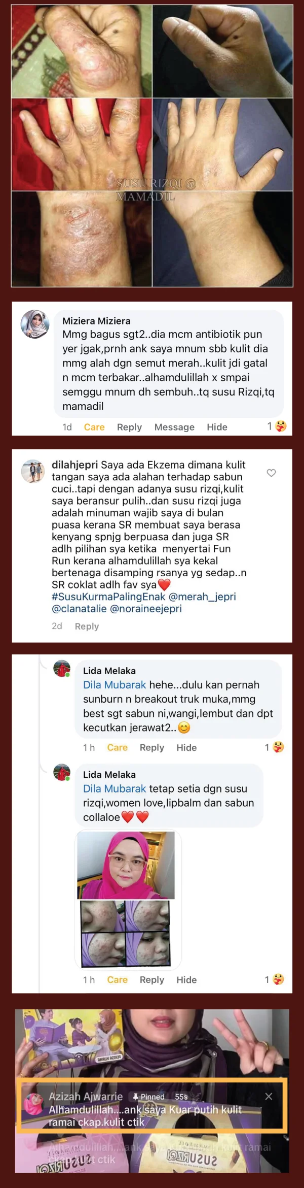 16 Feedback
