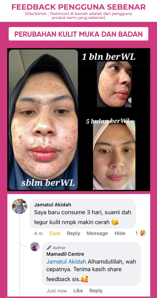 15 Testimoni 1